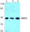 Carbohydrate Sulfotransferase 1 antibody, A10029, Boster Biological Technology, Western Blot image 
