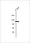 DENN Domain Containing 1A antibody, 64-185, ProSci, Western Blot image 