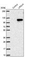 Leucine Rich Repeats And Guanylate Kinase Domain Containing antibody, NBP1-83518, Novus Biologicals, Western Blot image 