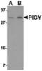 Phosphatidylinositol Glycan Anchor Biosynthesis Class Y antibody, TA306696, Origene, Western Blot image 