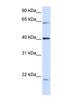 Spectrin Repeat Containing Nuclear Envelope Family Member 4 antibody, NBP1-59767, Novus Biologicals, Western Blot image 