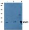 CCHC-Type Zinc Finger Nucleic Acid Binding Protein antibody, A03246-1, Boster Biological Technology, Western Blot image 
