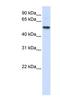 Ectonucleoside Triphosphate Diphosphohydrolase 8 antibody, NBP1-59484, Novus Biologicals, Western Blot image 