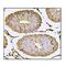 Nectin Cell Adhesion Molecule 2 antibody, A08081-2, Boster Biological Technology, Immunohistochemistry paraffin image 