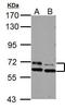 Serine/threonine-protein kinase PAK 3 antibody, GTX109991, GeneTex, Western Blot image 