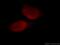 RNA Binding Motif Protein 15 antibody, 66059-1-Ig, Proteintech Group, Immunofluorescence image 