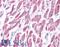 Sterol O-Acyltransferase 1 antibody, LS-C458330, Lifespan Biosciences, Immunohistochemistry frozen image 