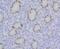 Chromatin assembly factor 1 subunit B antibody, NBP2-75439, Novus Biologicals, Immunohistochemistry paraffin image 