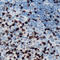 BCL6 Transcription Repressor antibody, LS-C368565, Lifespan Biosciences, Immunohistochemistry paraffin image 