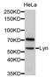 LYN Proto-Oncogene, Src Family Tyrosine Kinase antibody, abx127108, Abbexa, Western Blot image 