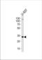 FMS antibody, TA324948, Origene, Western Blot image 