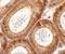 Spermatogenesis Associated 6 antibody, A14863, Boster Biological Technology, Immunohistochemistry paraffin image 