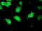 Katanin p80 WD40-containing subunit B1 antibody, TA503806, Origene, Immunofluorescence image 
