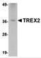 Three Prime Repair Exonuclease 2 antibody, 4971, ProSci Inc, Western Blot image 
