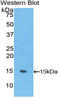 Uncoupling Protein 1 antibody, LS-C298486, Lifespan Biosciences, Western Blot image 