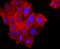 Fibroblast Growth Factor Receptor 3 antibody, NBP2-66840, Novus Biologicals, Immunofluorescence image 