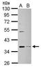 Dehydrogenase/Reductase 9 antibody, PA5-28550, Invitrogen Antibodies, Western Blot image 