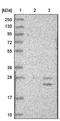 TATA-Box Binding Protein Associated Factor 12 antibody, NBP1-80703, Novus Biologicals, Western Blot image 