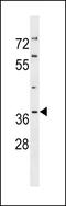 Tumor Protein P53 Inducible Protein 3 antibody, LS-C158658, Lifespan Biosciences, Western Blot image 