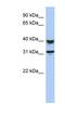 SET Domain Containing 9 antibody, NBP1-56742, Novus Biologicals, Western Blot image 