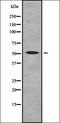 Glucosylceramidase Beta antibody, orb336870, Biorbyt, Western Blot image 