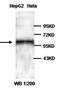 Pre-B-cell leukemia transcription factor 3 antibody, orb77175, Biorbyt, Western Blot image 