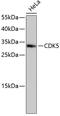 Cyclin Dependent Kinase 5 antibody, 13-813, ProSci, Western Blot image 