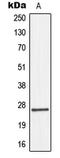 Gap Junction Protein Beta 2 antibody, LS-C352246, Lifespan Biosciences, Western Blot image 