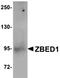 Zinc finger BED domain-containing protein 1 antibody, orb75174, Biorbyt, Western Blot image 
