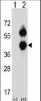 Branched Chain Amino Acid Transaminase 2 antibody, LS-C156762, Lifespan Biosciences, Western Blot image 