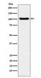 DNA Ligase 4 antibody, M01685, Boster Biological Technology, Western Blot image 