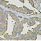 Survival Of Motor Neuron 2, Centromeric antibody, LS-C747605, Lifespan Biosciences, Immunohistochemistry paraffin image 
