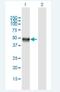 Ceroid-lipofuscinosis neuronal protein 5 antibody, H00001203-B01P-50ug, Novus Biologicals, Western Blot image 