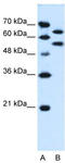 SIL1 Nucleotide Exchange Factor antibody, TA335482, Origene, Western Blot image 