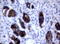 ERBB2 antibody, LS-C796705, Lifespan Biosciences, Immunohistochemistry paraffin image 