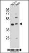 Zinc Finger Protein 384 antibody, 56-131, ProSci, Western Blot image 