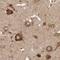 B Cell Receptor Associated Protein 29 antibody, NBP1-90009, Novus Biologicals, Immunohistochemistry paraffin image 