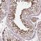Zinc Finger Protein 624 antibody, PA5-54712, Invitrogen Antibodies, Immunohistochemistry frozen image 