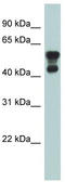 Platelet Activating Factor Acetylhydrolase 1b Regulatory Subunit 1 antibody, TA335149, Origene, Western Blot image 