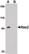 Regulating Synaptic Membrane Exocytosis 2 antibody, PA5-20522, Invitrogen Antibodies, Western Blot image 