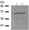 Histone deacetylase 5 antibody, TA323444, Origene, Western Blot image 