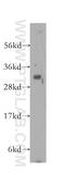 Gap Junction Protein Beta 1 antibody, 10450-1-AP, Proteintech Group, Western Blot image 