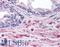 Engulfment And Cell Motility 2 antibody, LS-B4921, Lifespan Biosciences, Immunohistochemistry paraffin image 