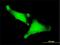 Zinc Finger Protein 175 antibody, H00007728-M01, Novus Biologicals, Immunocytochemistry image 