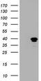 MAGE Family Member B1 antibody, CF800476, Origene, Western Blot image 