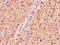 Glutathione S-Transferase Alpha 1 antibody, CSB-PA009970HA01HU, Cusabio, Immunohistochemistry paraffin image 