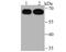 Ubiquitin carboxyl-terminal hydrolase 22 antibody, A03887, Boster Biological Technology, Western Blot image 