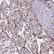 Protein LYRIC antibody, HPA015104, Atlas Antibodies, Immunohistochemistry frozen image 