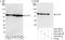 Chaperonin Containing TCP1 Subunit 8 antibody, A303-449A, Bethyl Labs, Western Blot image 
