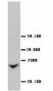 Gap Junction Protein Beta 2 antibody, LS-C171541, Lifespan Biosciences, Western Blot image 